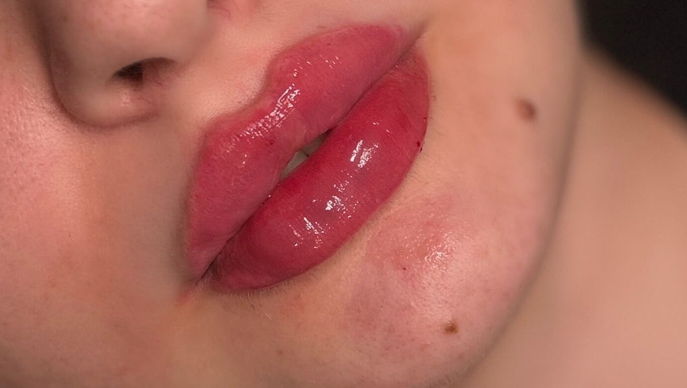 AC Signature Lips from the clinic’s own treatment portfolio